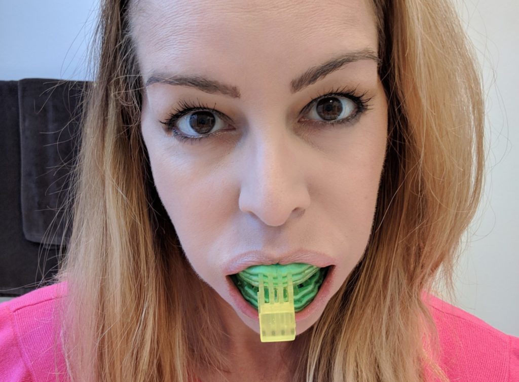 blizzident toothbrush review best, improved, new, dental, 3D, tech,